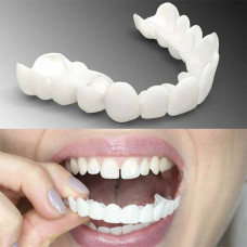 Знімна вініра для зубів Snap On Smile з кейсом